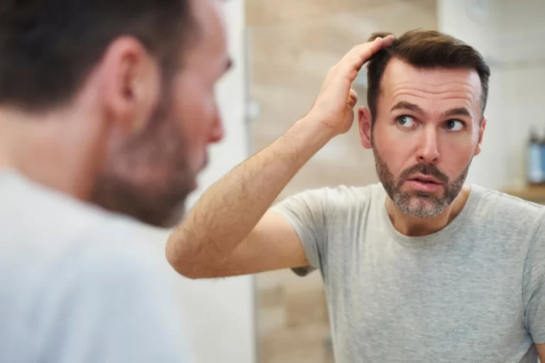بهترین مراکز کاشت مو کرج