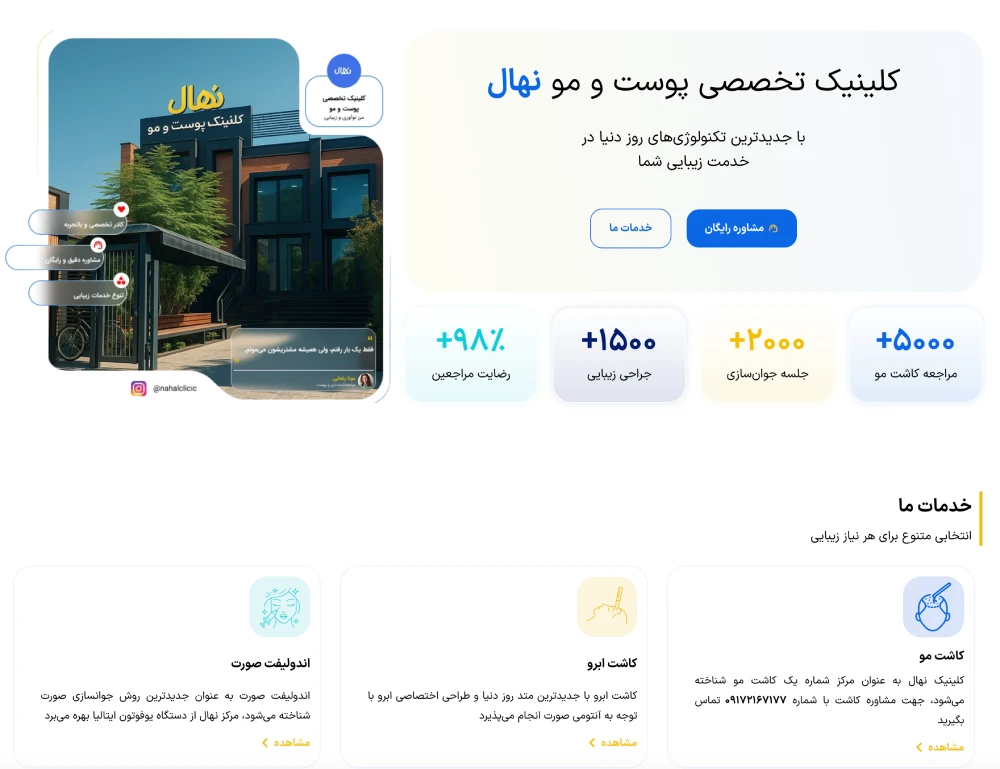 نهال بهترین کلینیک های کاشت مو شیراز