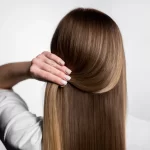 5 تا از بهترین کلینیک پروتز مو در تهران