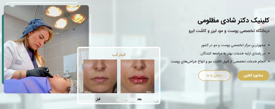 کلینیک پروتز مو شادی مظلومی