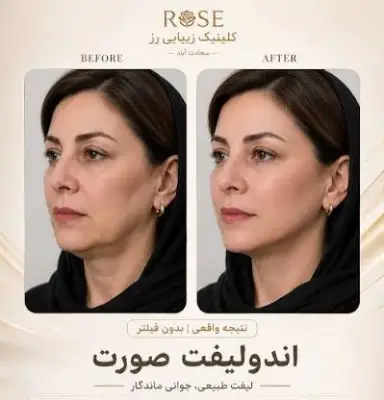 خدمات زیبایی رز سعادت آباد