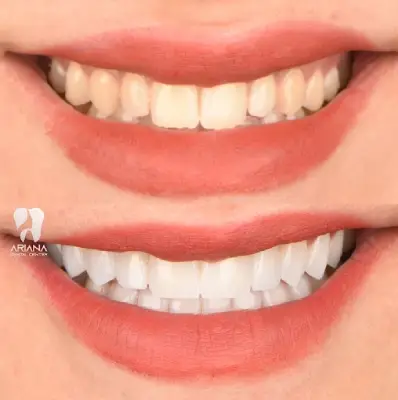 دندانپزشکی آریانا سعادت آباد