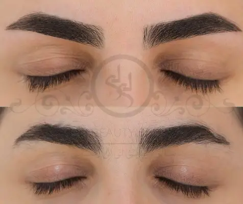 کاشت ابرو لی لی رضایی تهران