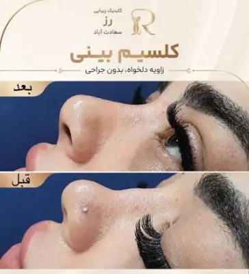 کلینیک زیبایی رز در سعادت آباد