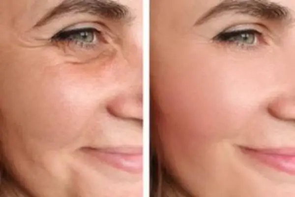خدمات پوست و مو کلینیک زیبایی ارکیده