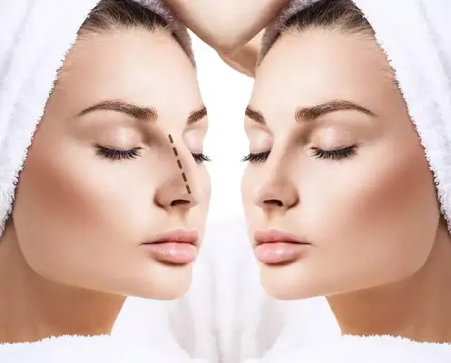 کلینیک زیبایی ایران نوین